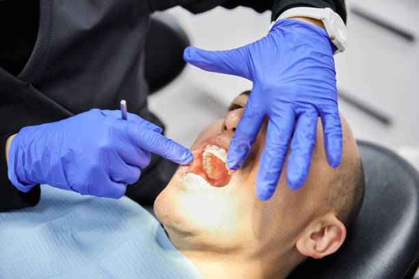 Best Broken or Chipped Tooth Repair in Allendale, SC